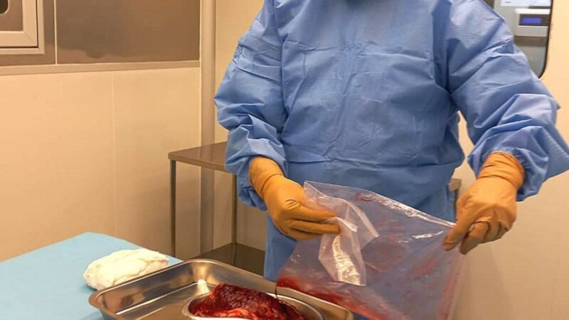Pesquisa desenvolve curativos biológicos à base de placenta