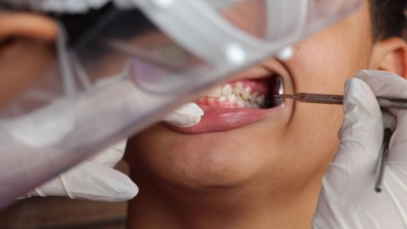 Lula sanciona PL que inclui política nacional de saúde bucal no SUS