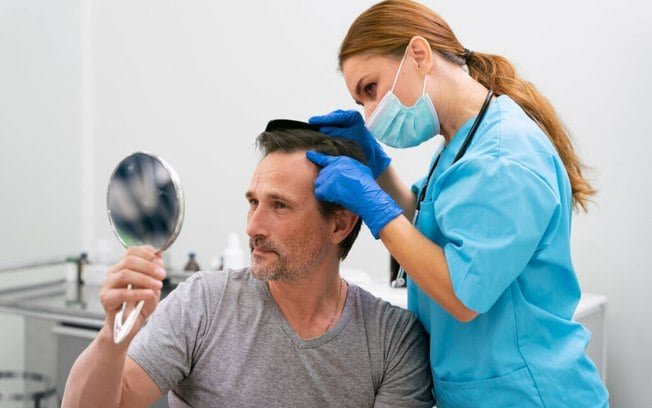 Alopecia: conheça as causas, os sintomas e os tratamentos