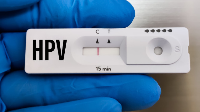 Autoteste para diagnóstico de HPV é lançado no Brasil