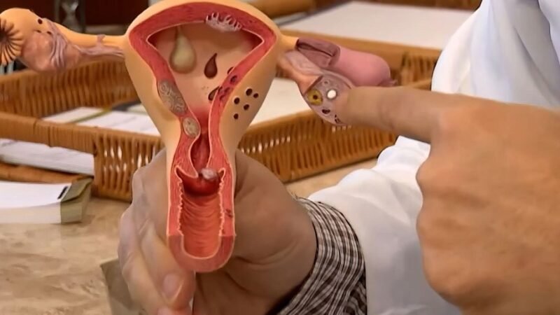 Julho Verde-Escuro conscientiza sobre prevenção ao câncer ginecológico