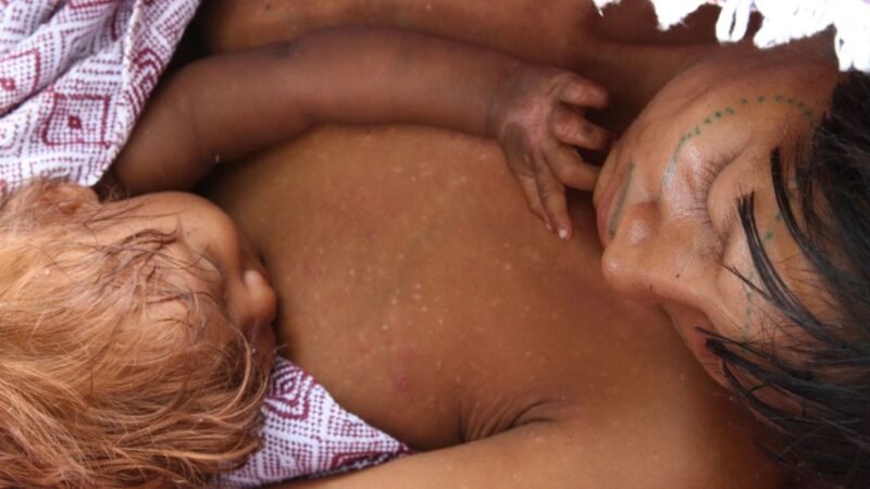 Pediatras pedem atenção para a saúde de crianças e jovens indígenas