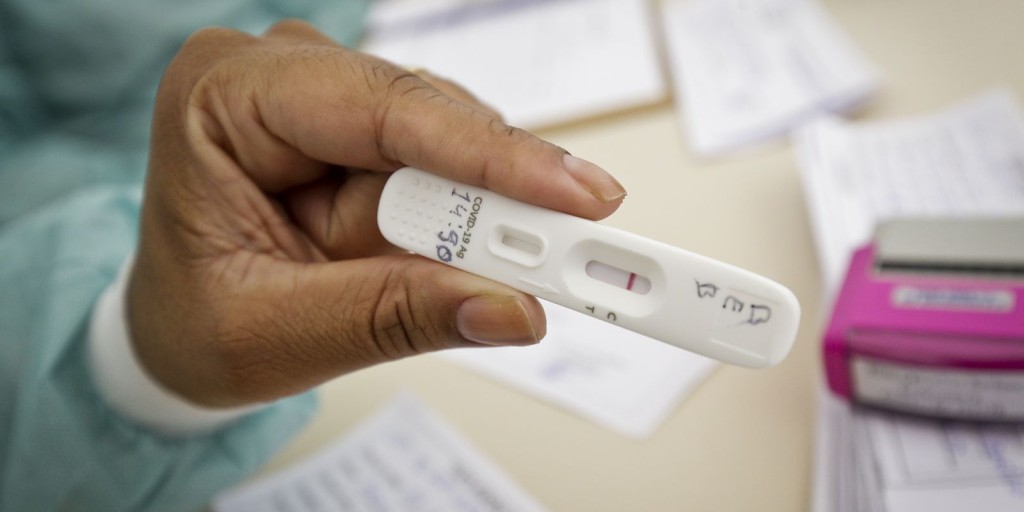 Positividade de testes de covid-19 subiu de 4% para 13%, diz UFRJ