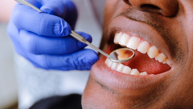 Brasil Sorridente deverá cobrir 62,5% da população em 2024