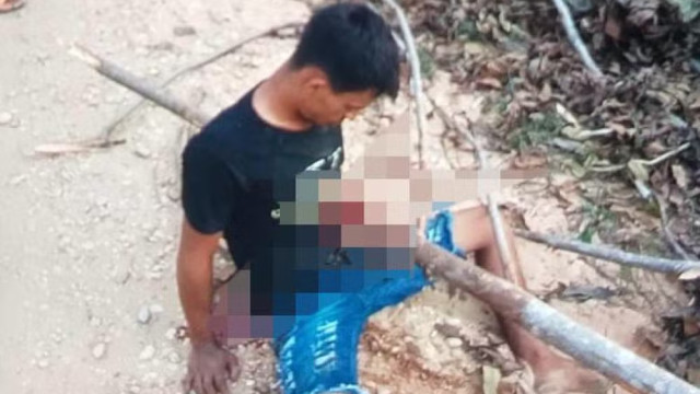 Rapaz fica com tronco atravessado no peito após acidente de moto