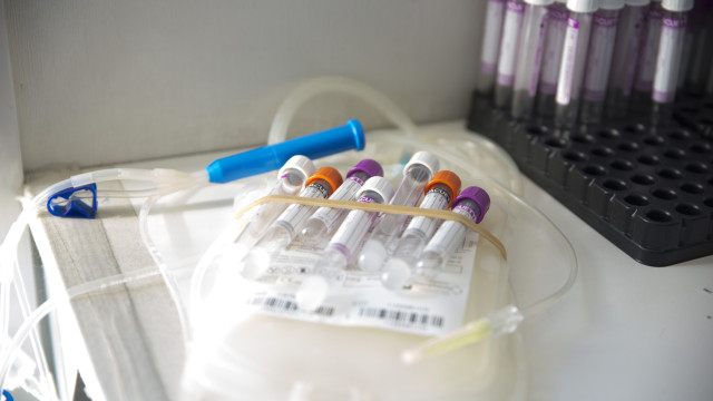 Notificação de infecções pelo vírus HTLV passa a ser compulsória