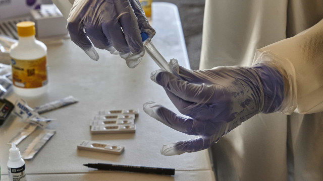 SUS incorpora teste para detecção de HPV em mulheres