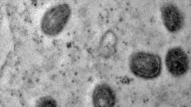 Cientistas confirmam circulação de vírus mayaro em humanos em Roraima; entenda riscos