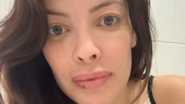 Após volutariado, Jaque rebate comentários de haters e mostra machucados