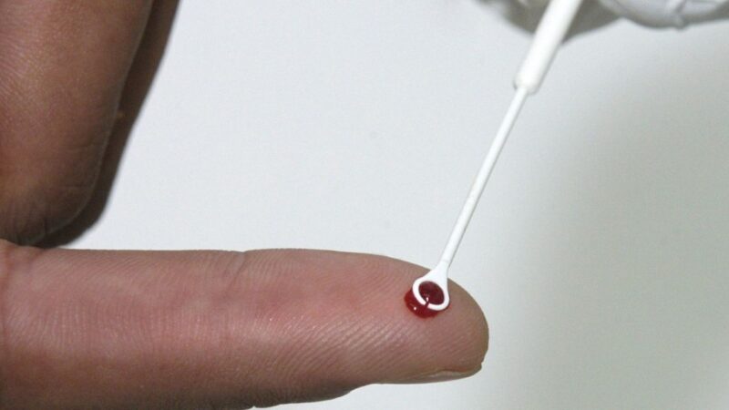 Saúde amplia vacinação contra o HPV para quem usa PrEP