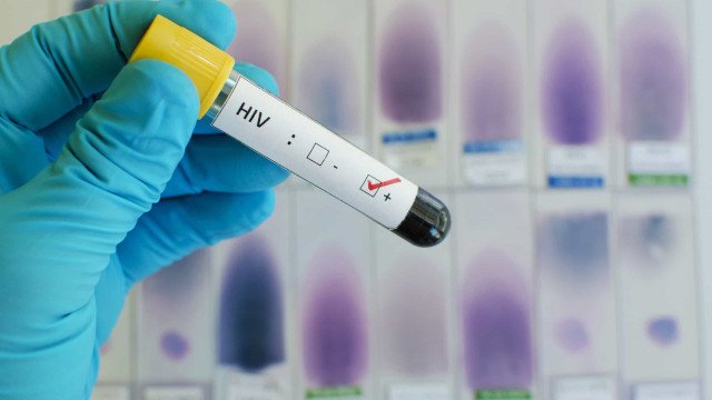 Nova variante do HIV é detectada na Bahia, no Rio de Janeiro e no Rio Grande do Sul