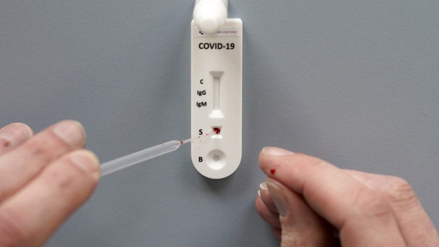 Fiocruz aponta sinais de queda em alta recente da covid-19 no país