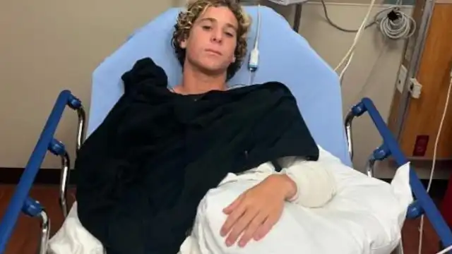 Surfista da seleção é atacado por tubarão na Flórida