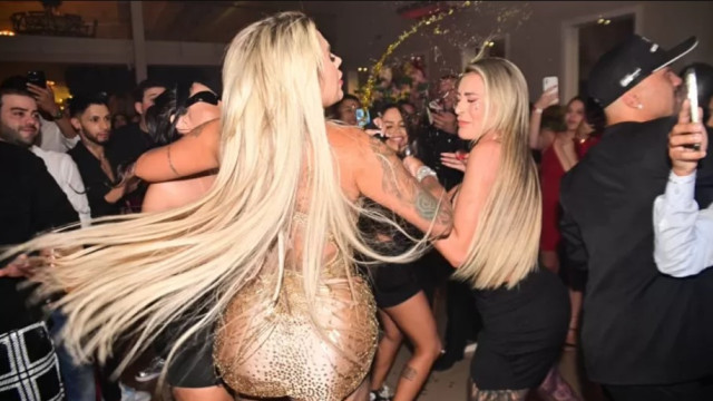 Andressa Urach é agredida em festa e leva 4 pontos no rosto