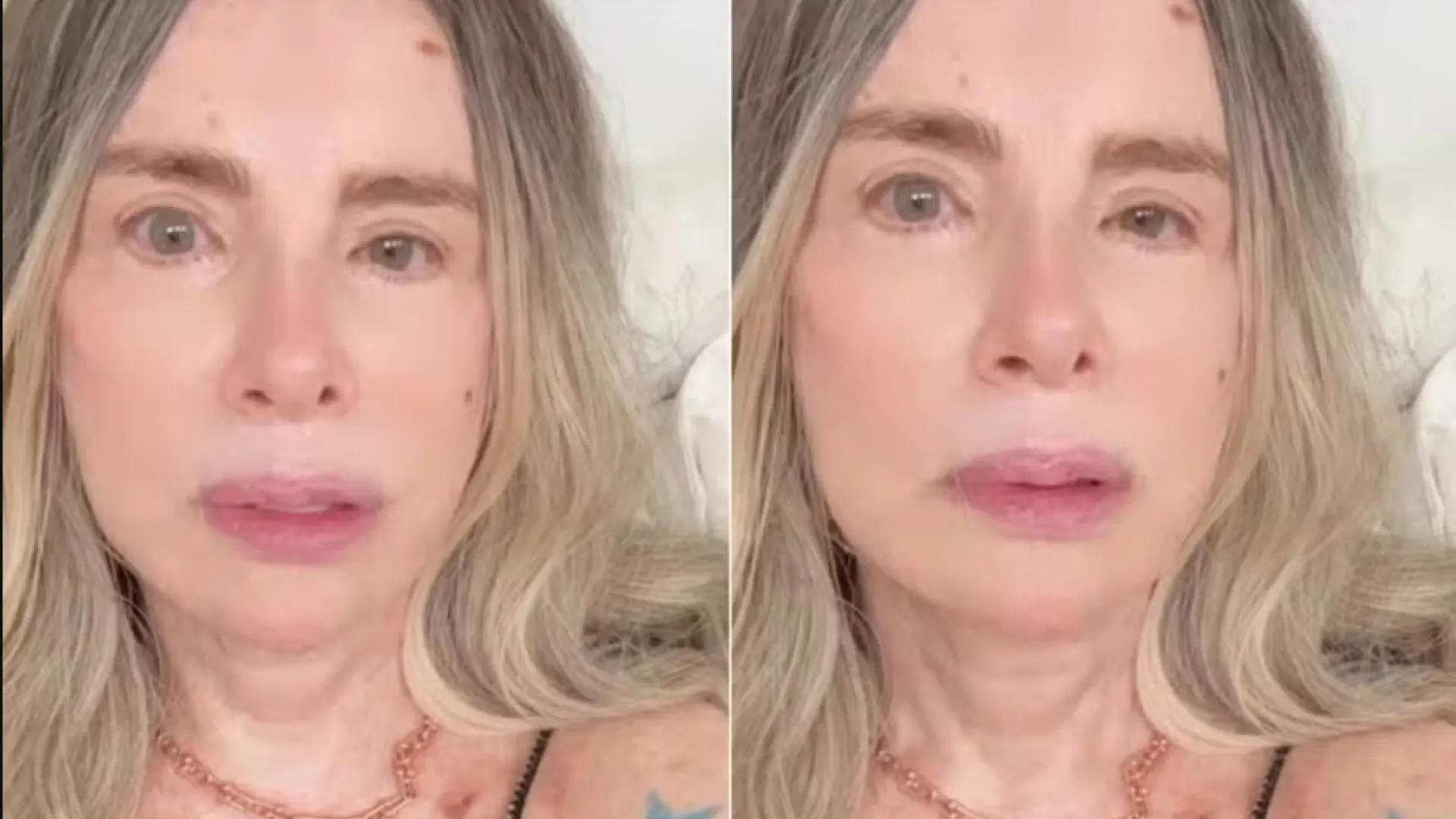 Isis de Oliveira comemora cura do câncer de pele: ‘Estou livre’