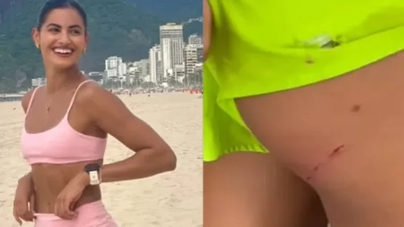 Letícia Salles é atacada por cinco cachorros e leva mordida no bumbum
