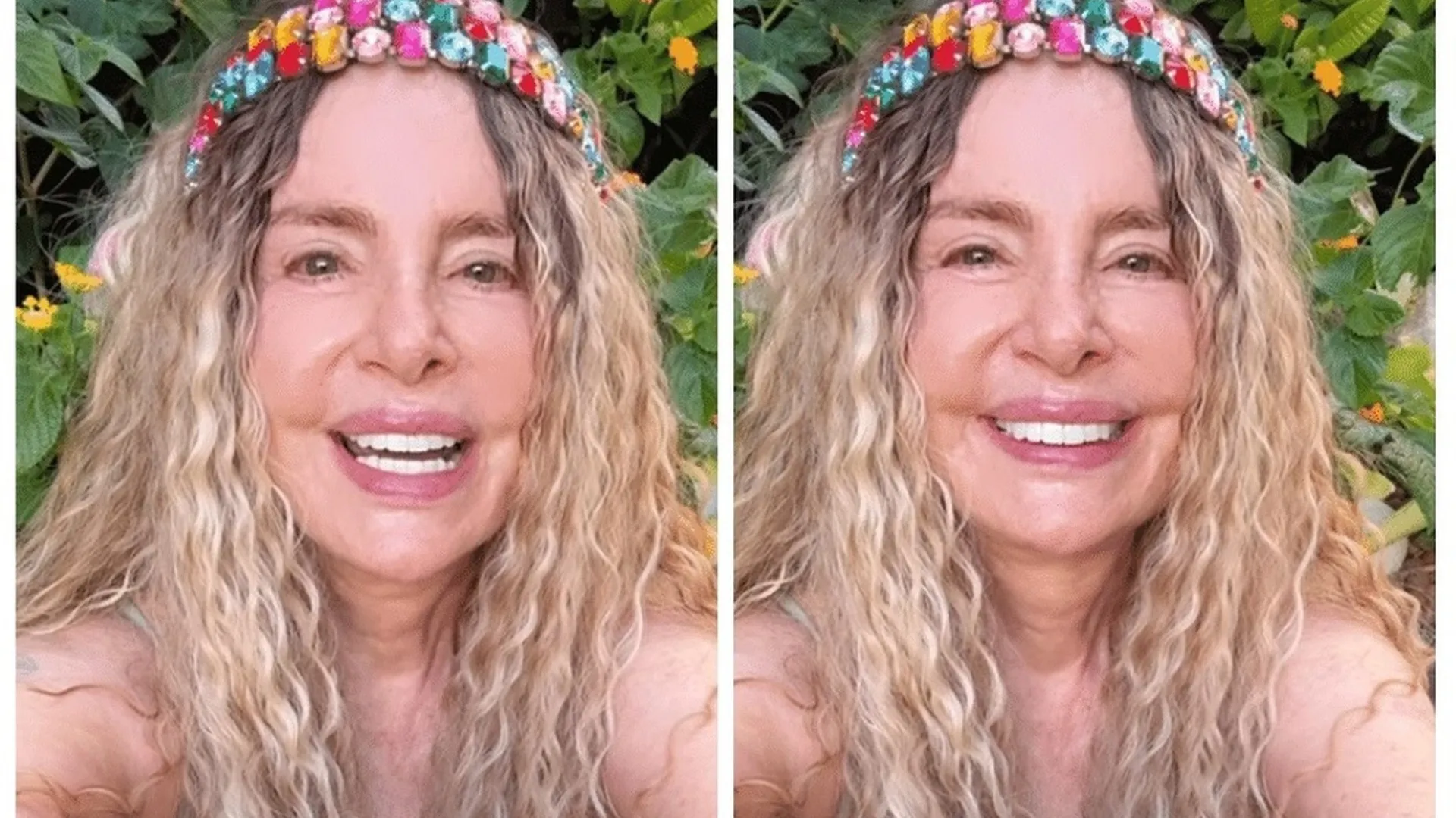 Isis de Oliveira rebate críticas por procedimentos estéticos