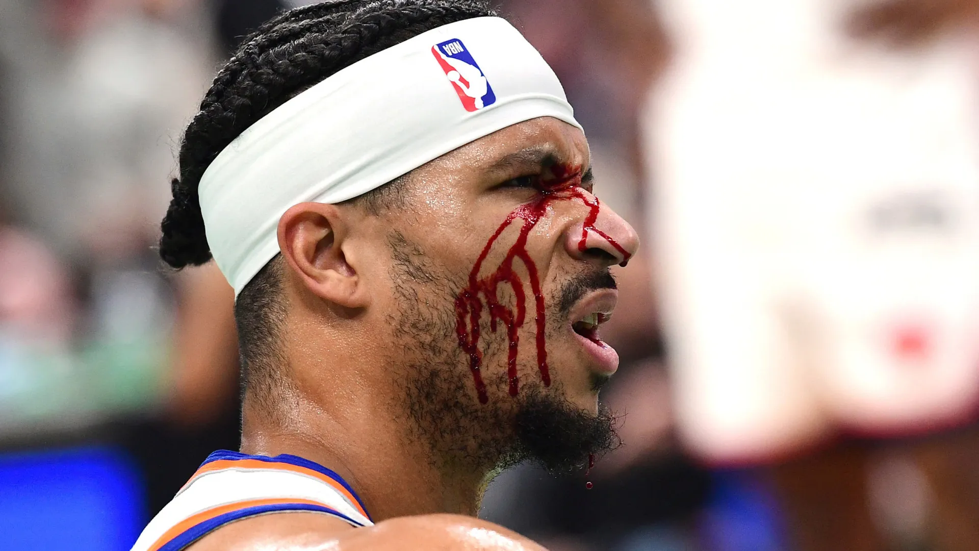 Jogador dos New York Knicks fica sangrando após cotovelada