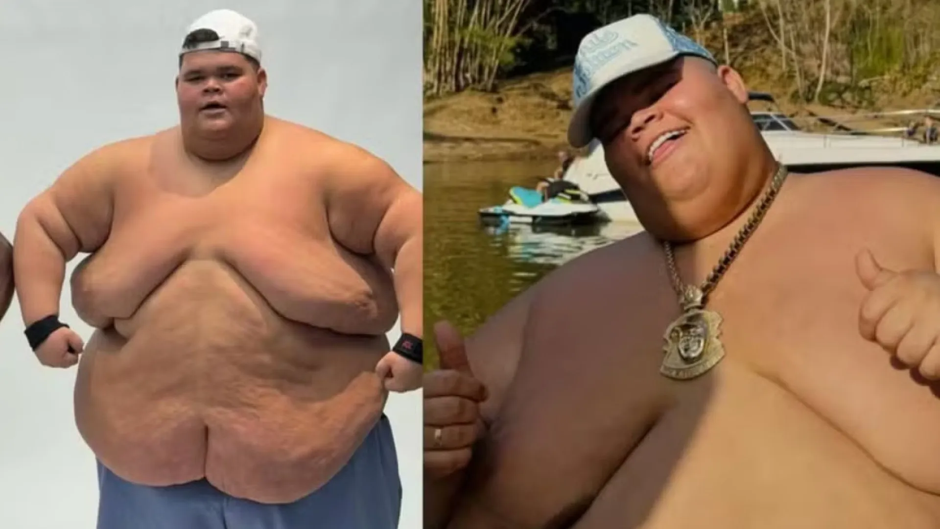 Após perder 75 kg, Gordão da XJ quer andar em elevador