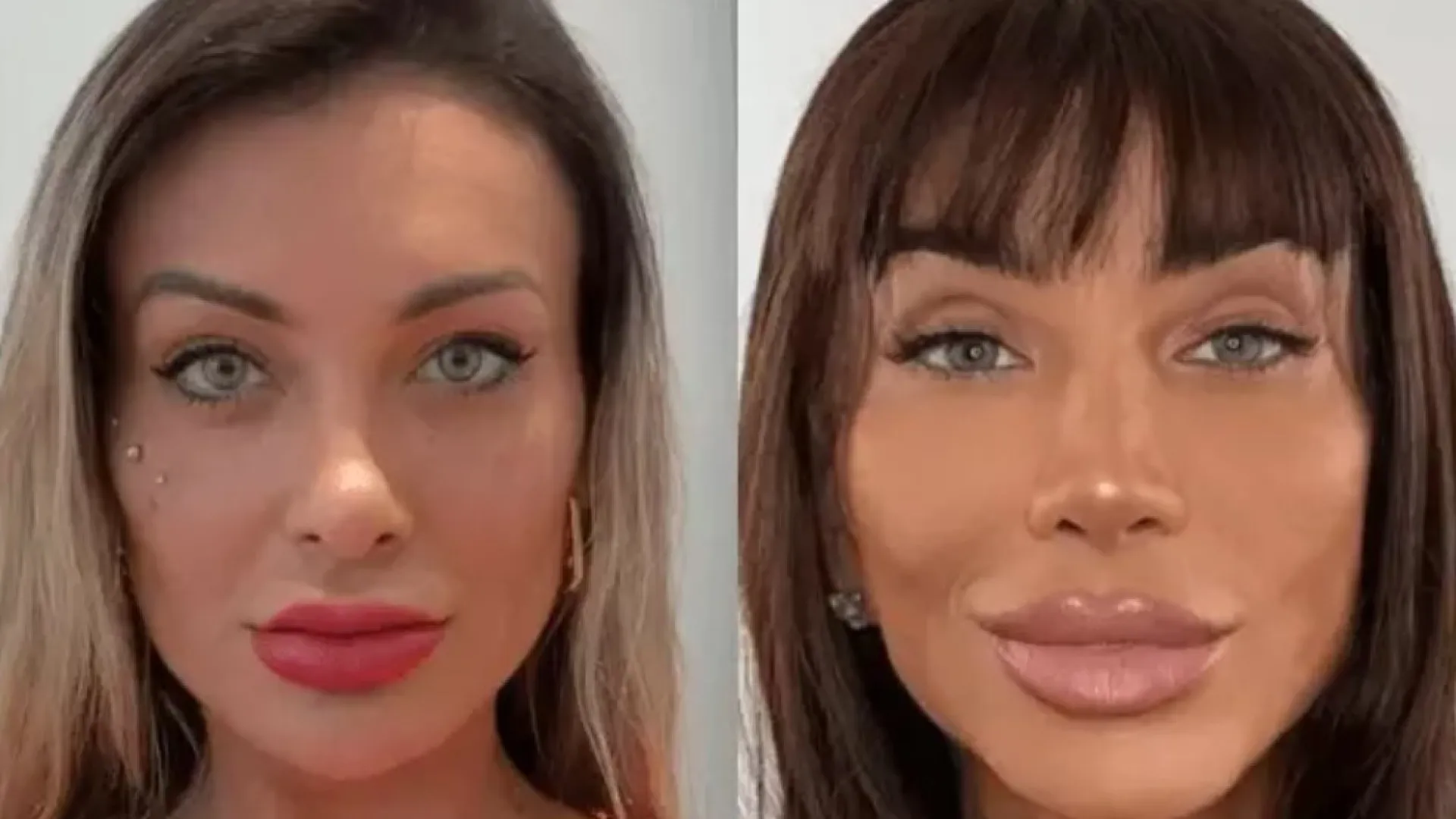 Entenda os riscos da cirurgia feita por Andressa Urach e Maya Massafera para mudar a cor dos olhos