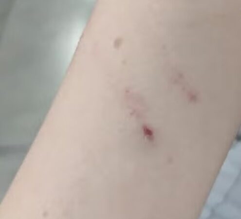 Aluna é agredida por homem em situação de rua dentro da UFMT; suspeito está foragido