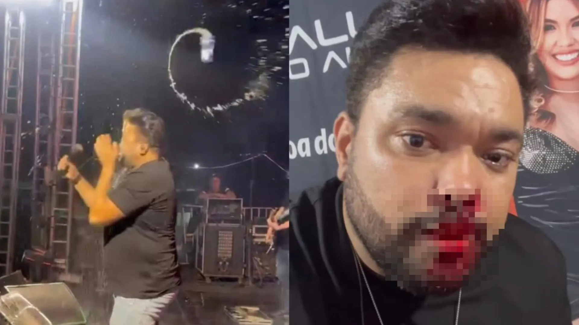 Cantor é atingido por lata no rosto e sai do show sangrando em MT
