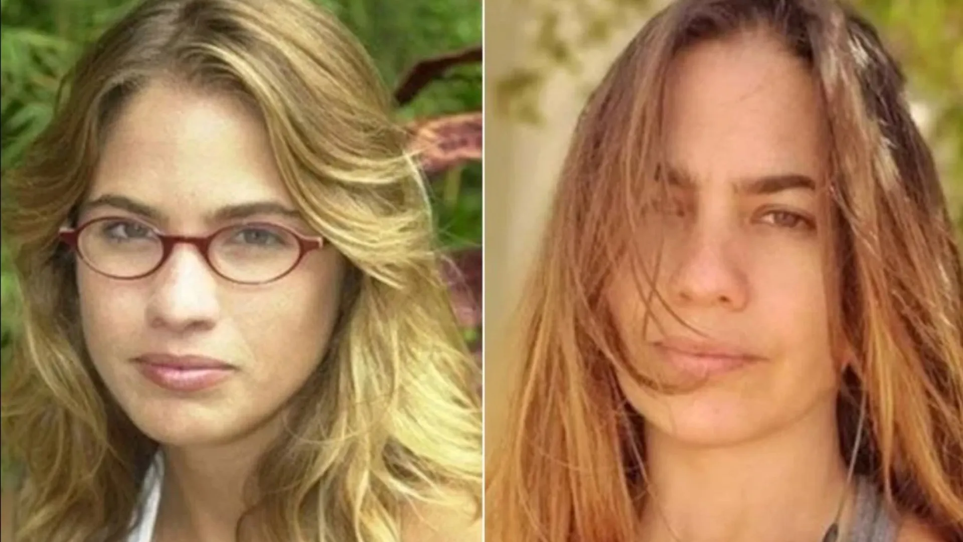 Atriz de malhação fica cega após ser agredida e expõe abusos