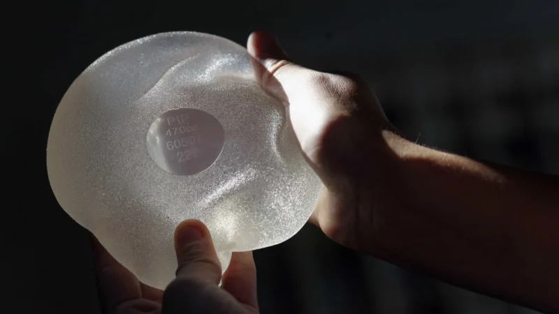 Brasileira de 38 anos morre por câncer raro associado a prótese de silicone