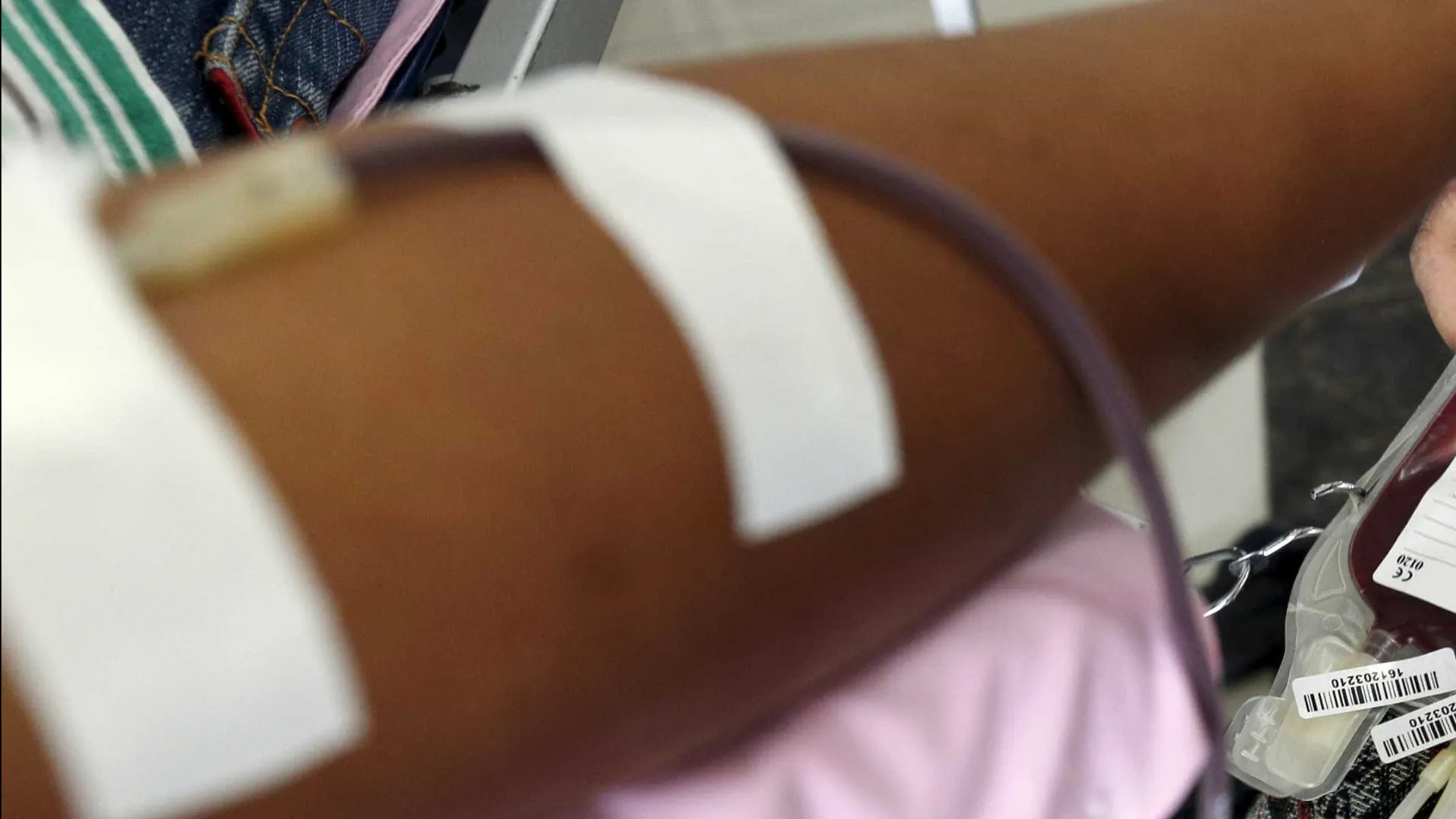 Homem contaminado por ácido durante hemodiálise morre no RJ após coma