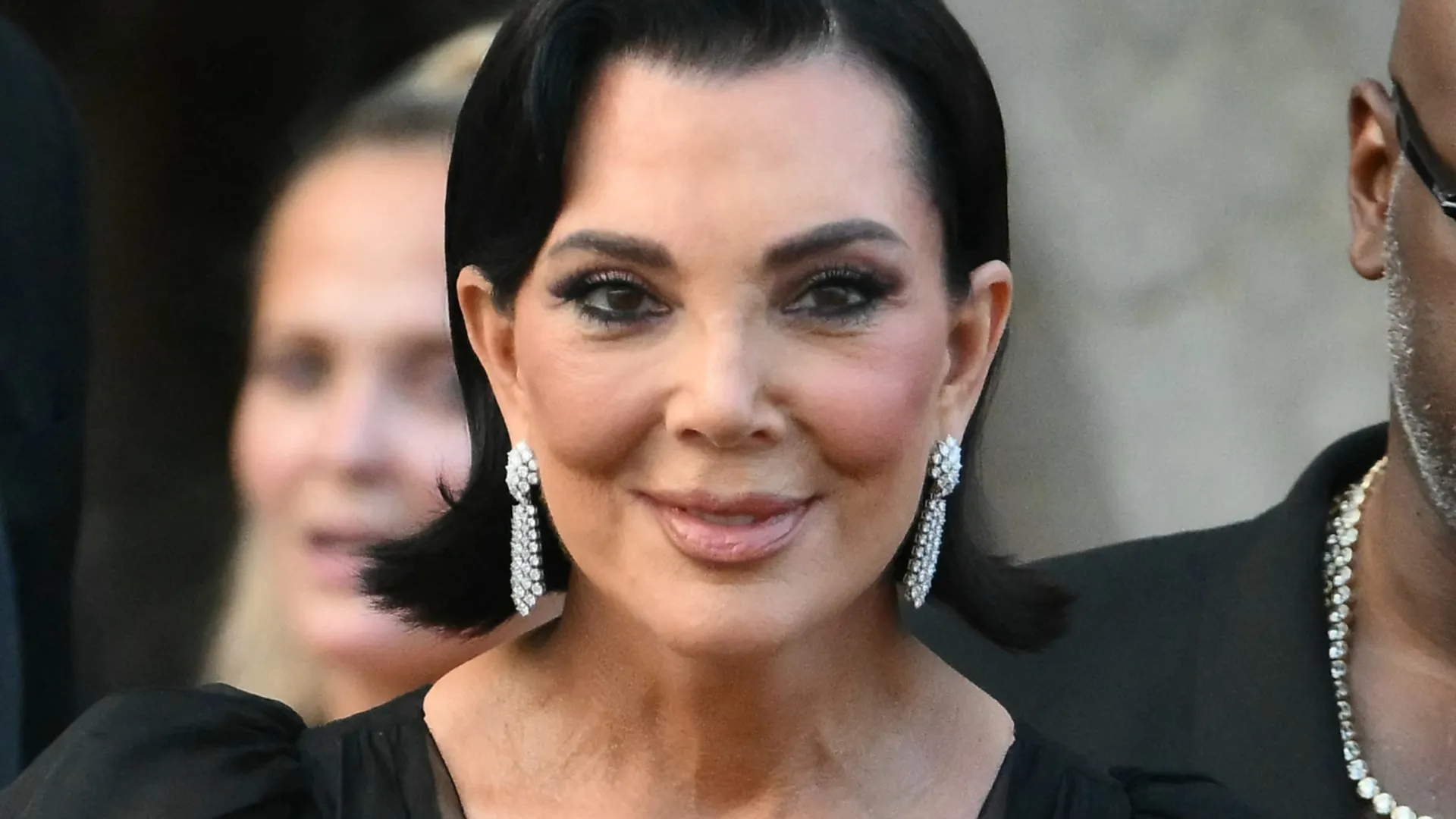 Famosos e suas cirurgia plásticas