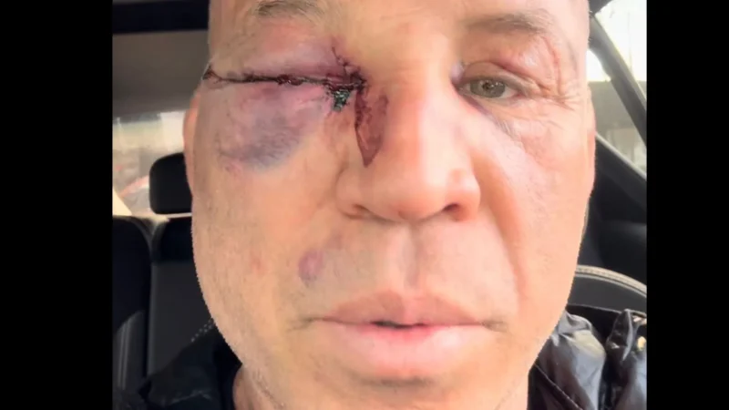 “Fui covardemente agredido”, diz Wanderlei sobre briga com Popó