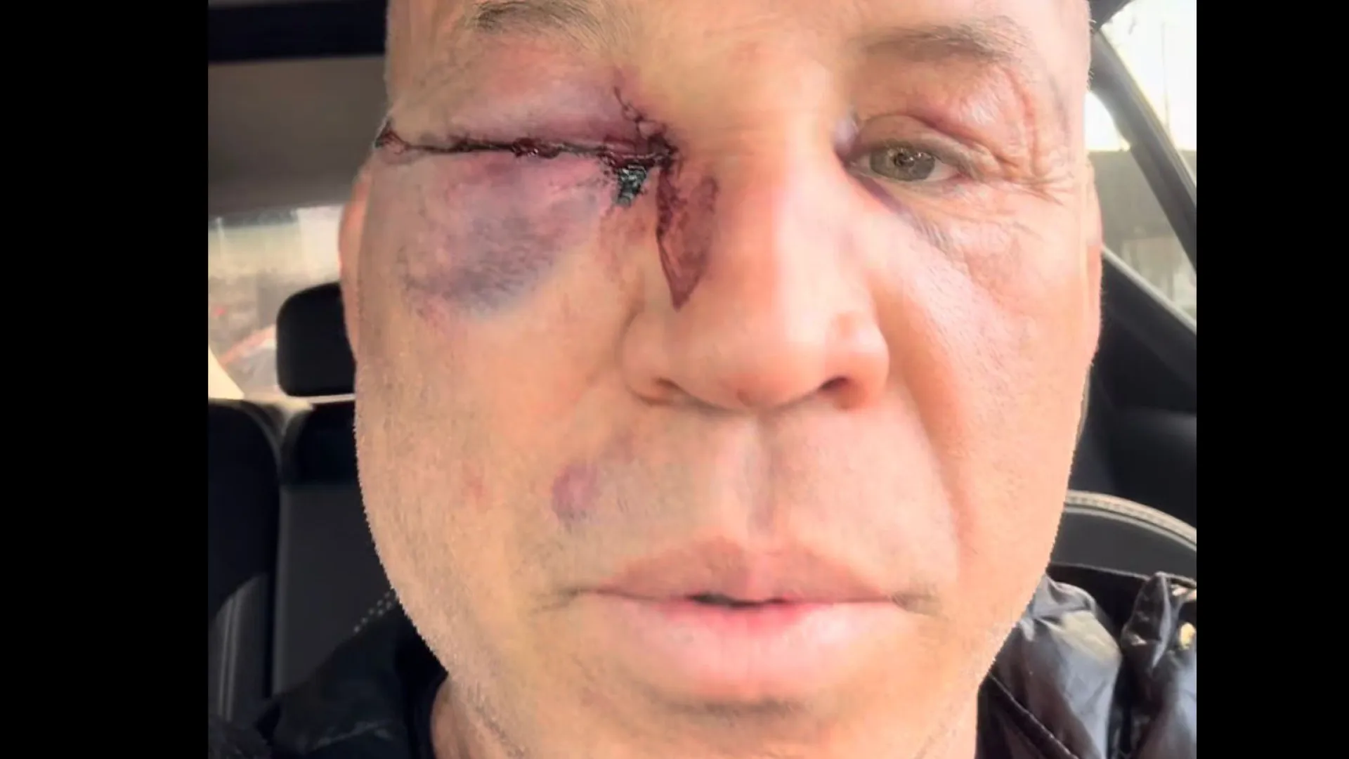 “Fui covardemente agredido”, diz Wanderlei sobre briga com Popó