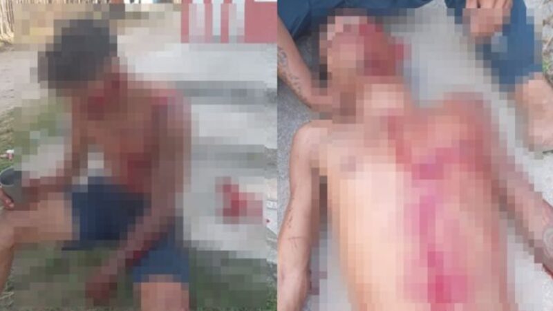 IMAGENS FORTES! Jovem é atacado pelas costas com terçado durante discussão; Veja Vídeo