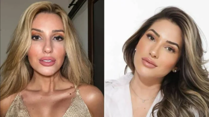 Ex-BBB Amanda Meirelles chama a atenção por transformação e lista procedimentos