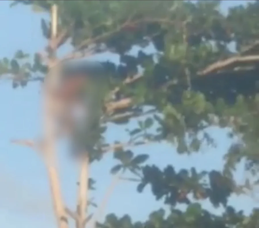 Acidente grave: estaca atravessa lateral do corpo de menino no interior do MA (vídeo) ATENÇÃO IMAGENS FORTES!!!