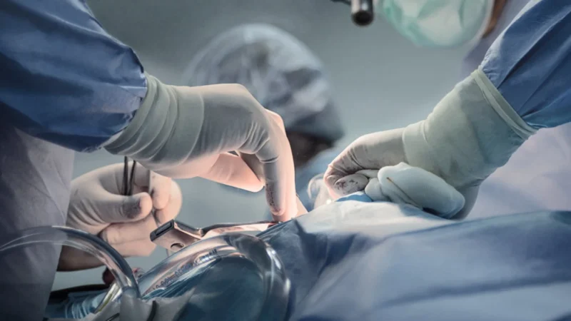 Gêmeos siameses morrem após cirurgia de separação em Goiânia