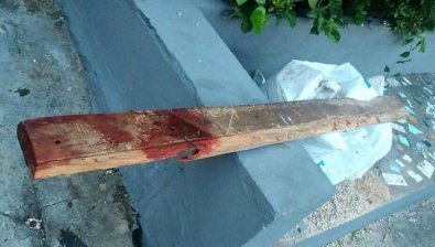 Homem é atacado com paulada na cabeça dentro de casa em distrito de Cáceres