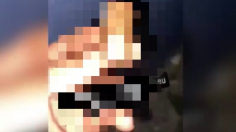 Vídeo mostra dedo decepado e levanta suspeita de crime violento