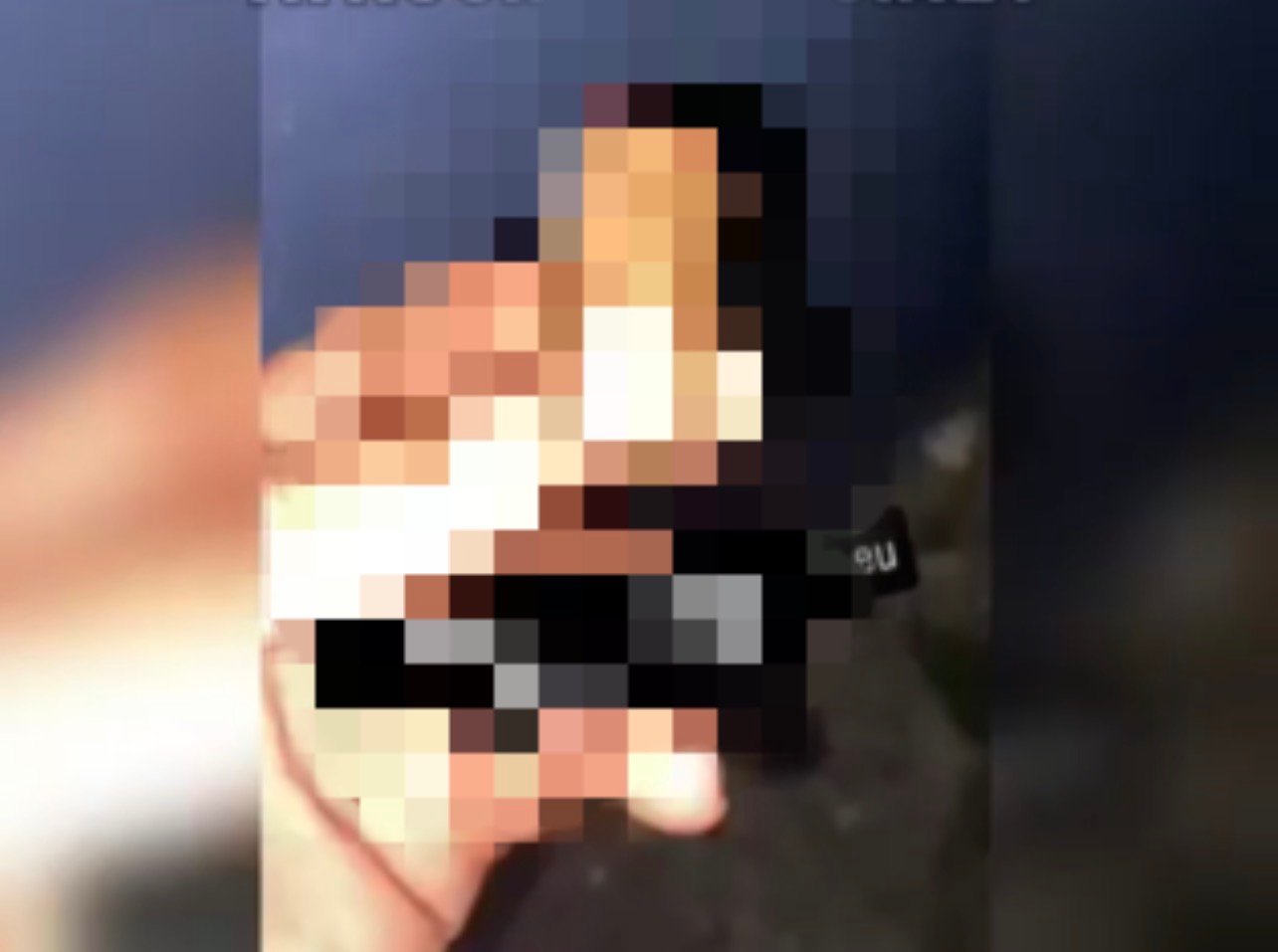 Vídeo mostra dedo decepado e levanta suspeita de crime violento