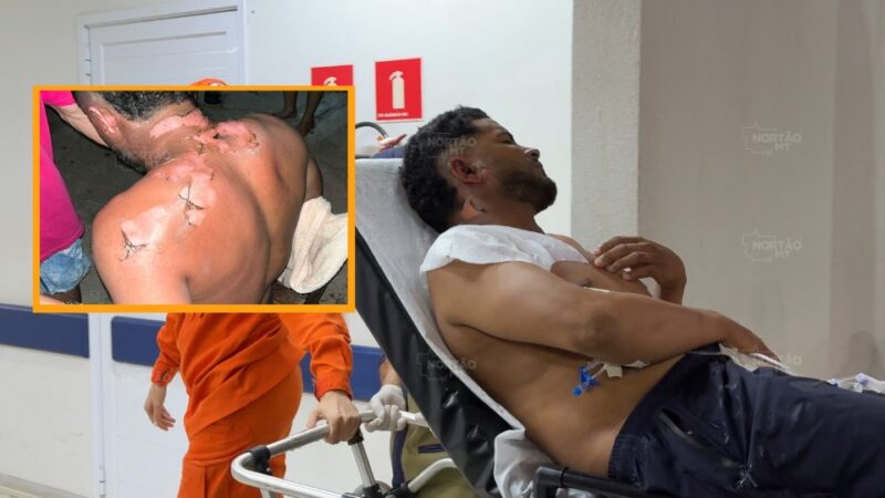 Homem sofre queimaduras graves após ser incendiado durante briga em MT