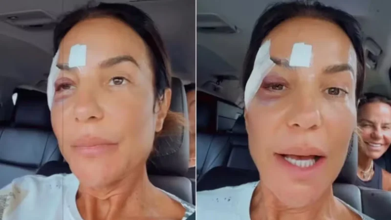 Ivete Sangalo passa por cirurgia neste domingo, diz portal