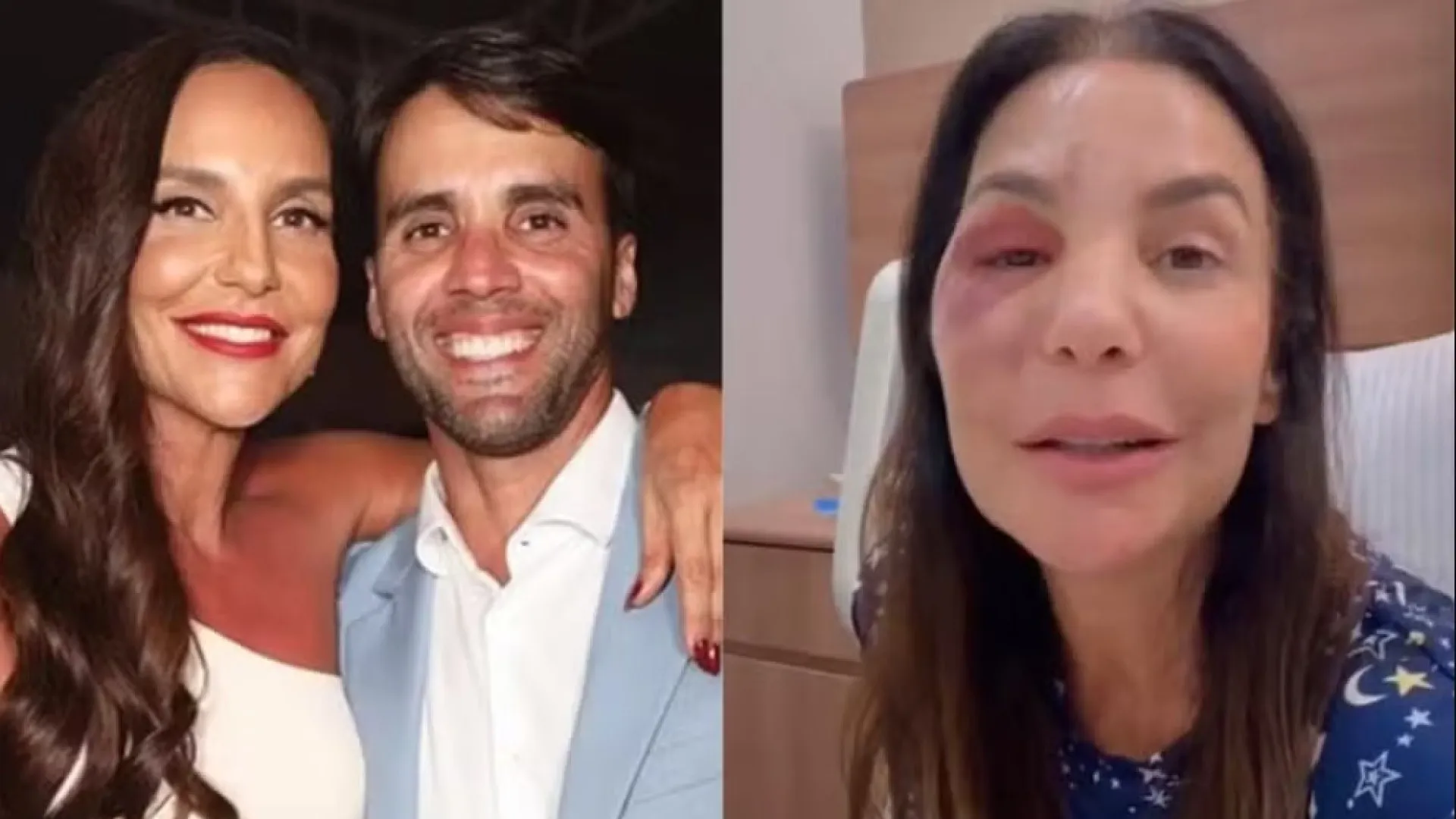 Ex-marido de Ivete fala sobre a cirurgia da cantora: ‘Mulher de aço’