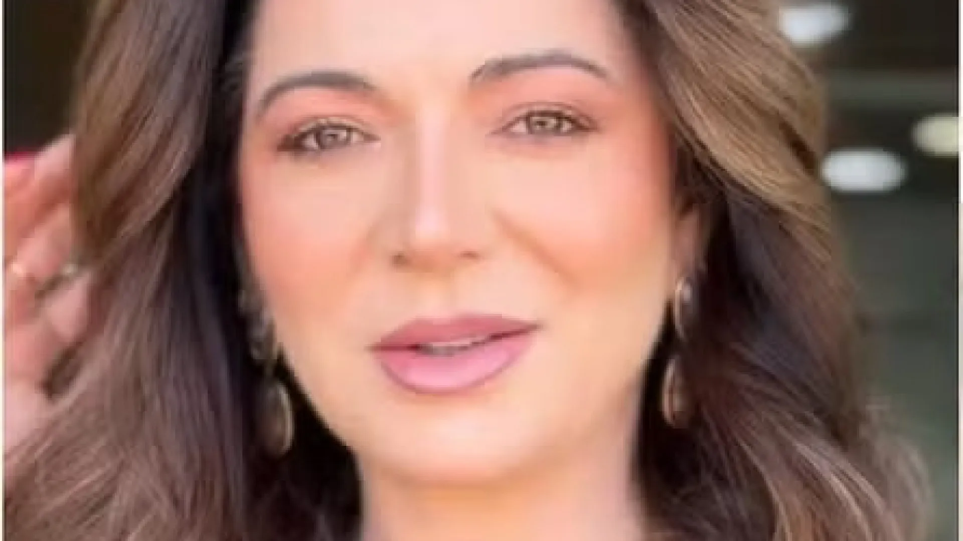 Karina Lucco abre o coração sobre alopecia e mostra evolução do cabelo