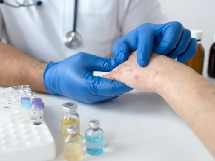 SUS autoriza antibiótico para prevenir sífilis e clamídia após exposição a risco