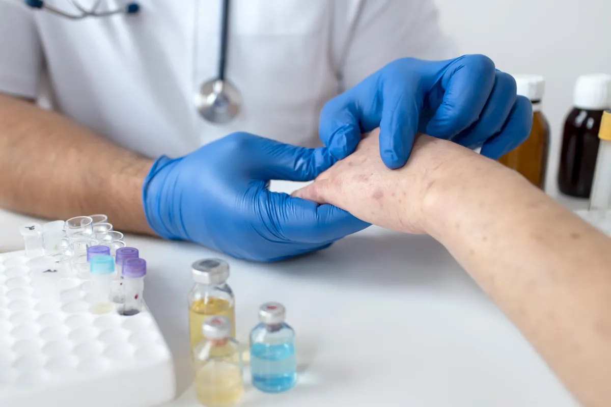 SUS autoriza antibiótico para prevenir sífilis e clamídia após exposição a risco