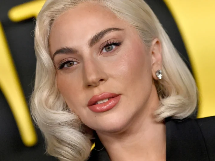 Lady Gaga cancela show por motivos de saúde: “O meu estado piorou”