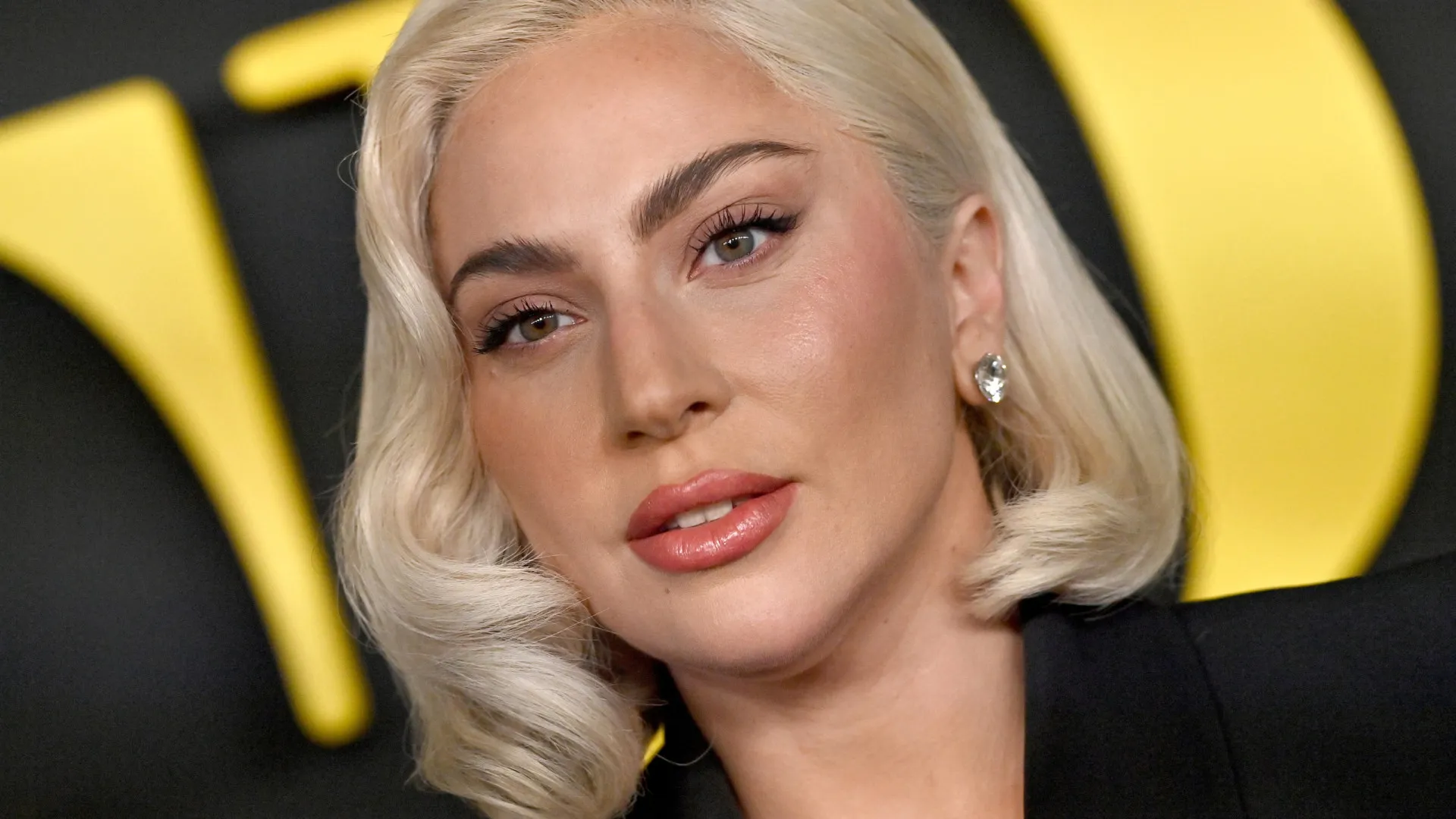 Lady Gaga cancela show por motivos de saúde: “O meu estado piorou”