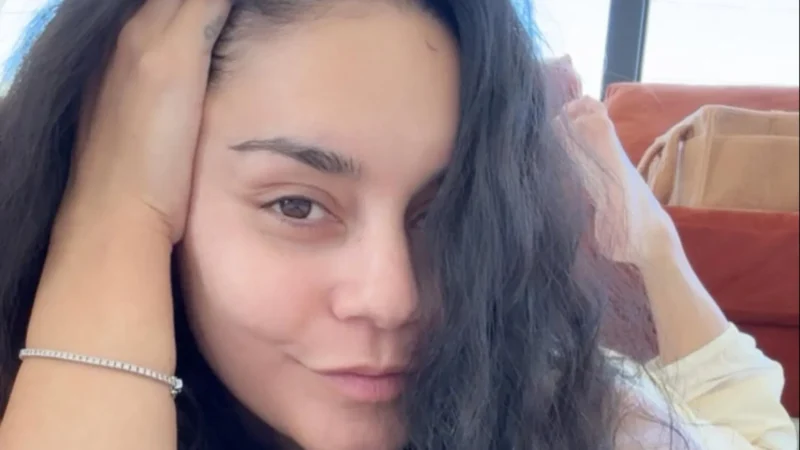 Vanessa Hudgens mostra queda de cabelo pós-parto