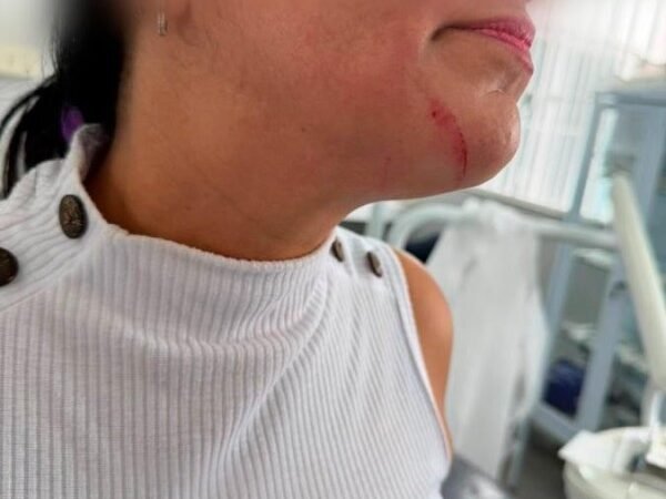 Servidora é agredida por paciente em unidade de saúde