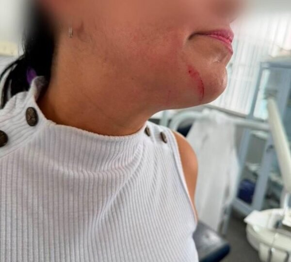 Servidora é agredida por paciente em unidade de saúde